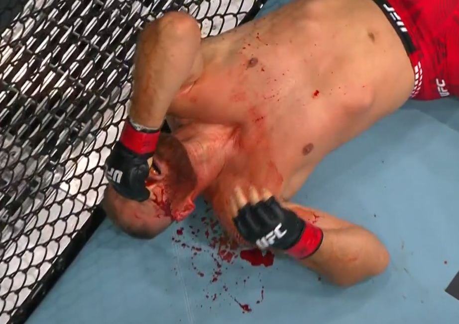 UH... MMA BORAC POKAZAO KAKO MU IZGLEDA LICE POSLE JEZIVOG NOKAUTA U BEOGRADU! Doktori su morali da ga ušivaju, pogledajte fotku o kojoj svi pričaju!