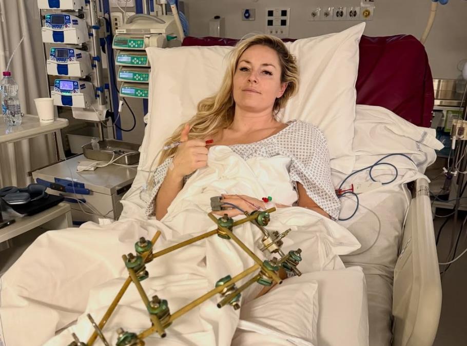KO BI REKAO?! LINDZI VON NEKOLIKO MESECI POSLE NEZAPAMĆENE TRAGEDIJE UVRŠTENA U REPREZENTACIJU SAD! Navijači u šoku, svi misle da je klikbejt, ali...
