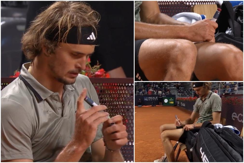 ZVEREV GODINAMA SKRIVAO NEIZLEČIVU BOLEST! Ismevali su ga, krio se u toaletu da primi terapiju, a danas je šampion i inspiracija milionima! (VIDEO)