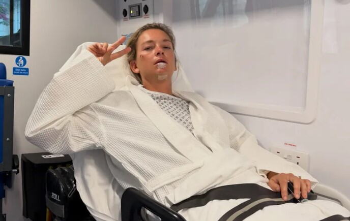 HOROR NESREĆA LEGENDARNE TENISERKE! Krenula na Vimbldon, pa doživela BIZARAN PAD: Lice joj je UNAKAŽENO do neprepoznatljivosti, potresne fotke sve šokirale!