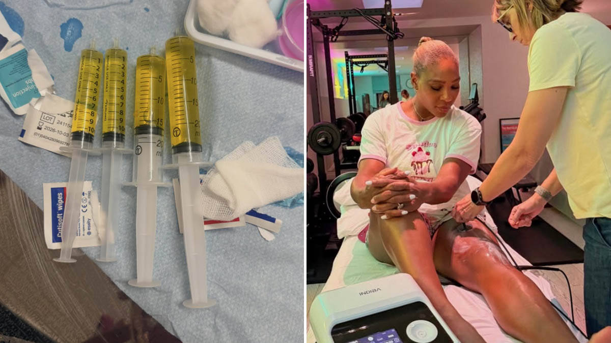 "Ovo su mi lekari izvukli iz kolena": Serena Vilijams sa Vimbldona objavila uznemirujuće fotografije